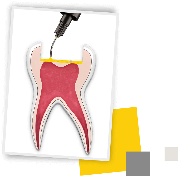 Tooth1