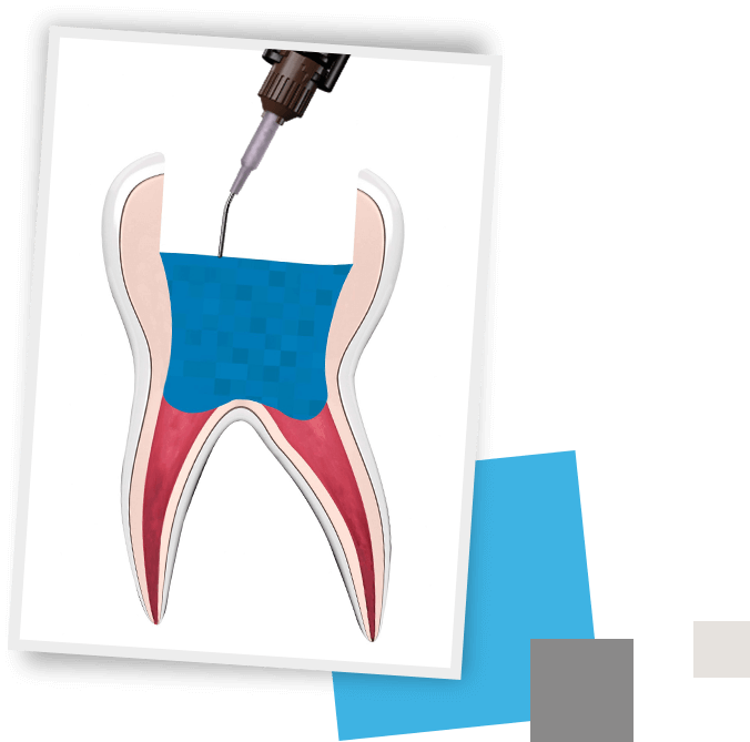 Tooth2