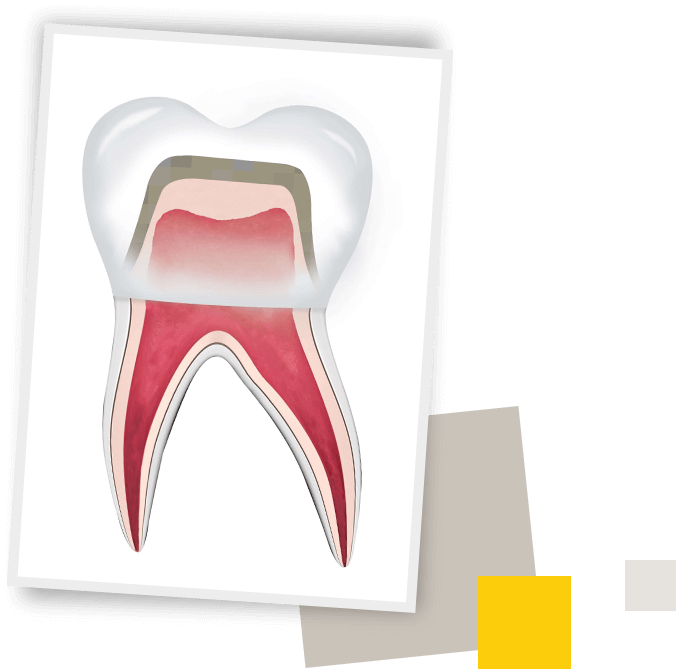 Tooth3