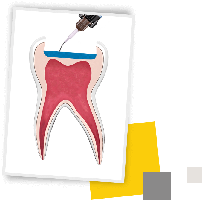 Therabase-Tooth1